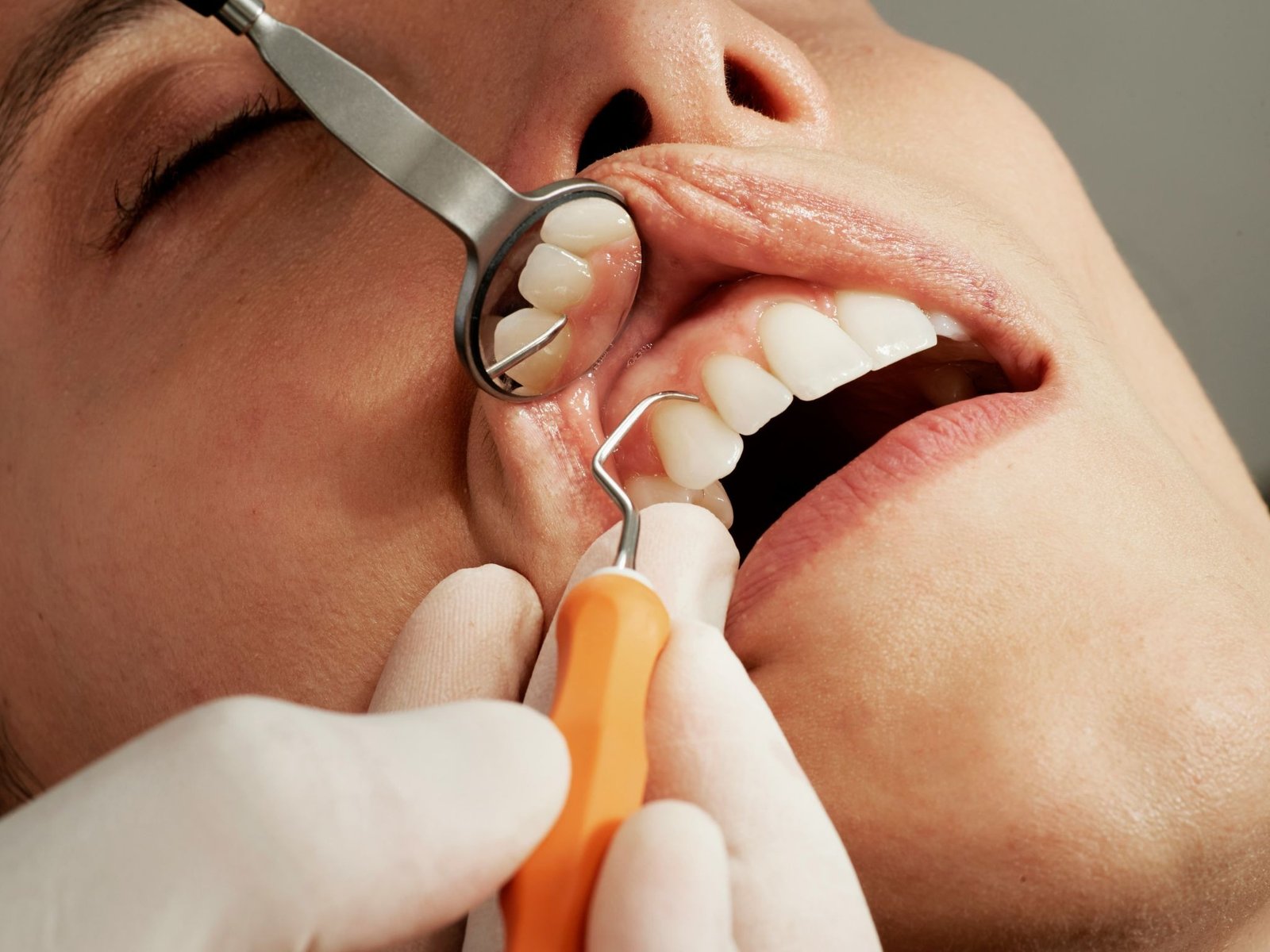 Dental Implant Dentist: What Gets Checked Before Placement Day